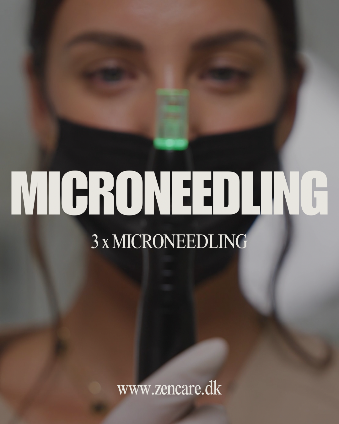 3 x MICRONEEDLING